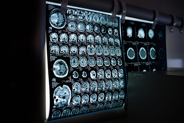 Czy można zrobić rezonans magnetyczny całego kręgosłupa?
