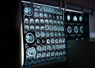 Kiedy nie można wykonać tomografii komputerowej?